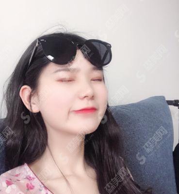 中山大学附属第三医院整形烧伤科价目表2020,内含切开双眼皮案例