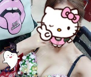 杭州117医院整形科的具体实力介绍/隆胸案例分享/附恢复过程图