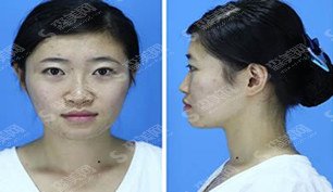 东大整形医院怎么样的/东大整形的案例分享/附东大整形医院简介