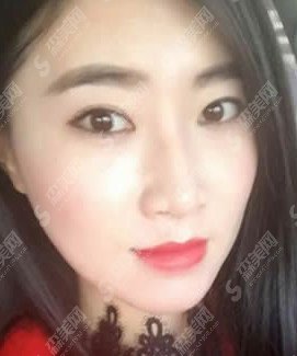 东大整形医院怎么样的/东大整形的案例分享/附东大整形医院简介