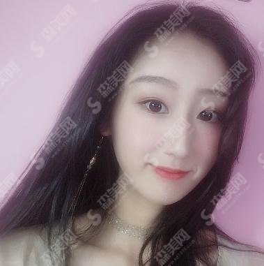 上海德琳医疗美容医院价格表2020,鼻翼缩小价格,附鼻翼缩小果对比