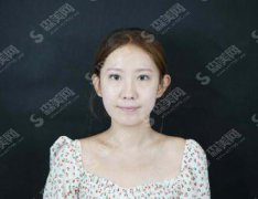 北京联合丽格第一医疗美容医院美容价格表2020，价格，内含果图