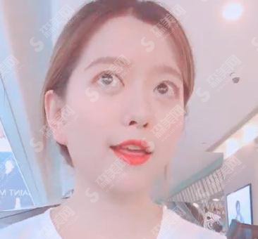 北京市海淀医院价格表2021,隆鼻价格,附肋骨鼻部手术案例果图