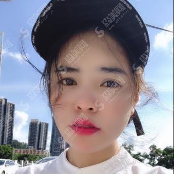 上海首尔丽格价目表2020/磨骨价格怎么样/内附崔荣达医生的磨骨果图