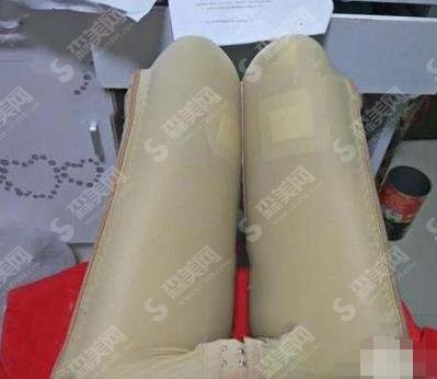 北京八大处整形医院价目表2021，内含焦虎医生大腿吸脂案例前后果图对比