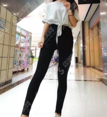 北京八大处整形医院价目表2021，内含焦虎医生大腿吸脂案例前后果图对比