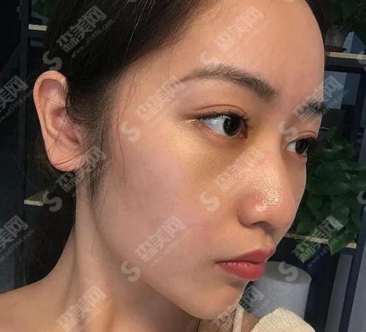 成都新颐美医疗美容整形门诊部价目表2021,内含激光去眼袋案例果图