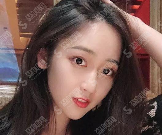 成都新颐美医疗美容整形门诊部价目表2021,内含激光去眼袋案例果图