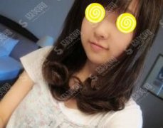 深圳北大医院整形价目表2021注射瘦脸果怎么样？注射瘦脸注射医生介绍/内附注射瘦脸注射康复过程图