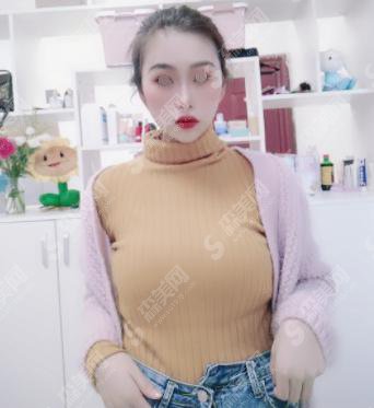 内含北京协和整形医院的介绍,王阳医生注射瘦脸真实案例分享