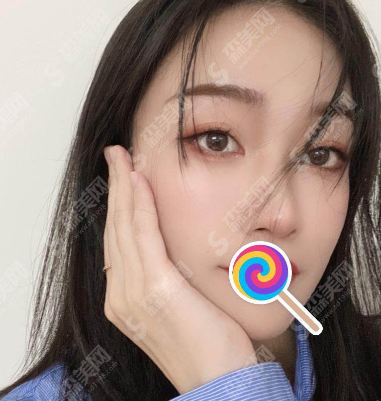 王珏整形医生专业吗？附王珏医生个人介绍及祛痘案例分享