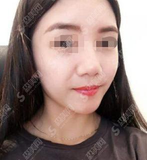 上海九院医院口碑好不好？内含2020祛斑项目较新价目表&范先群医生介绍&医生祛疤案例果对比