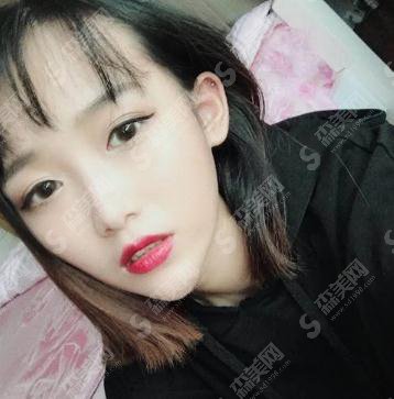 整形专家臧梦青眼部手术专业吗?北京八大处/口碑如何/案例展示