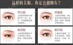 切双眼皮需要多少钱？附切双眼皮案例+前后果对比图