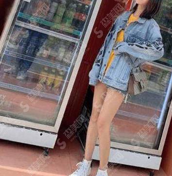 整形专家王春虎怎么样?王春虎做的吸脂果好不好?附医院介绍及案例分享