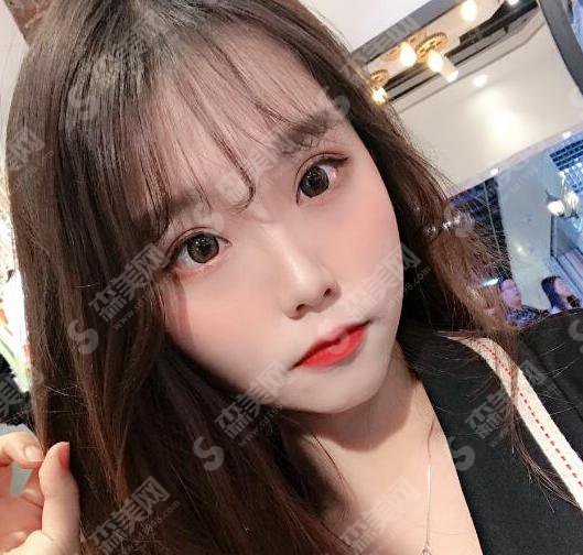 西京医院做的双眼皮果好不好?附西京医院介绍以及孙峰医生介绍&2021双眼皮手术价格一览&双眼皮手术整形