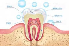 牙齿冷光美白要多少钱？附牙齿冷光美白案例+前后果对比图