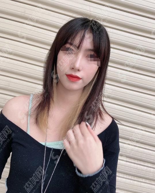 李斌斌医生怎么样？李医生做的隆鼻好不好附医院简介及李医生做隆鼻的案例分享