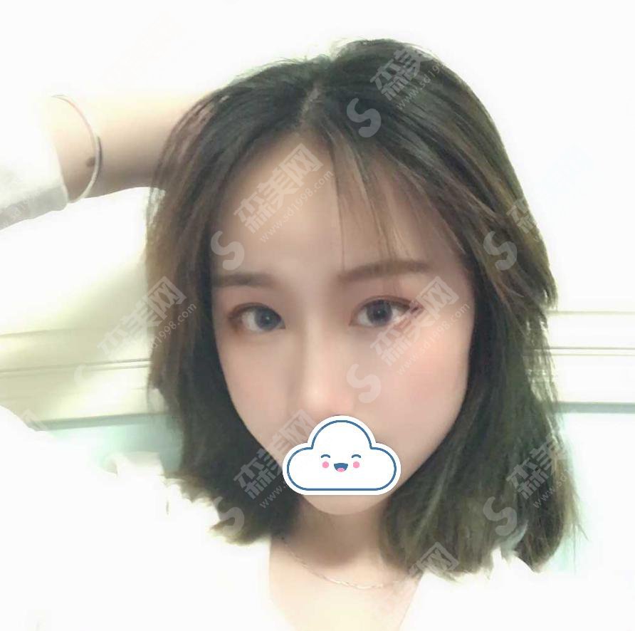 西京医院整形美容中心怎么样?西京医院整形美容中心医院介绍及整形成功案例分享