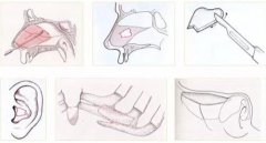肋软骨隆鼻需要多少钱?附肋软骨隆鼻案例+前后果对比图