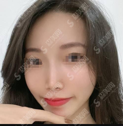 整形专家王梦怎么样？王梦做的整形果好不好？附医院介绍及整形案例