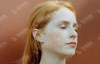 光子嫩肤祛斑的价格？光子嫩肤祛斑有何优势？