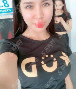 内含上海九院的介绍,闵沛如医生假体隆胸案例分享