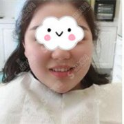 长春烤瓷牙的价目表2021,烤瓷牙的果好不好?内附较新烤瓷牙的价目表