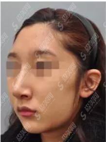 魏娴医生怎么样？魏娴医师做的鼻子矫正怎么样？附医院介绍及医师案例