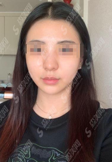 杨希医生怎么样?杨希医生做的鼻子咋样?附医院介绍及整形案例