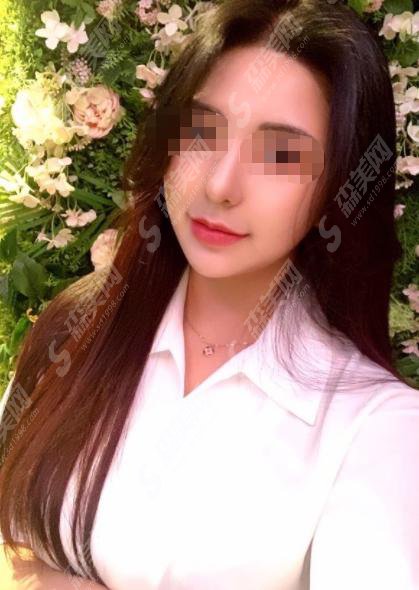 杨希医生怎么样?杨希医生做的鼻子咋样?附医院介绍及整形案例