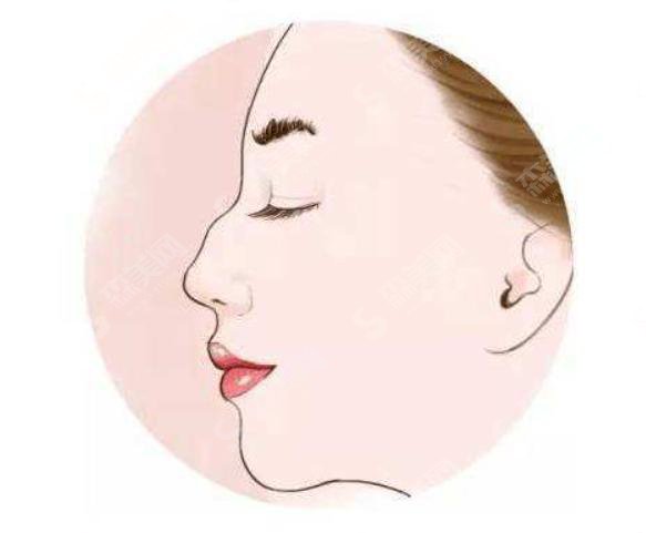 驼峰鼻矫正需要花费多少钱?附驼峰鼻矫正费用一栏及驼峰鼻矫正成功案例分享