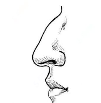 驼峰鼻矫正多少钱?驼峰鼻矫正果好不好?附驼峰鼻介绍及案例分享