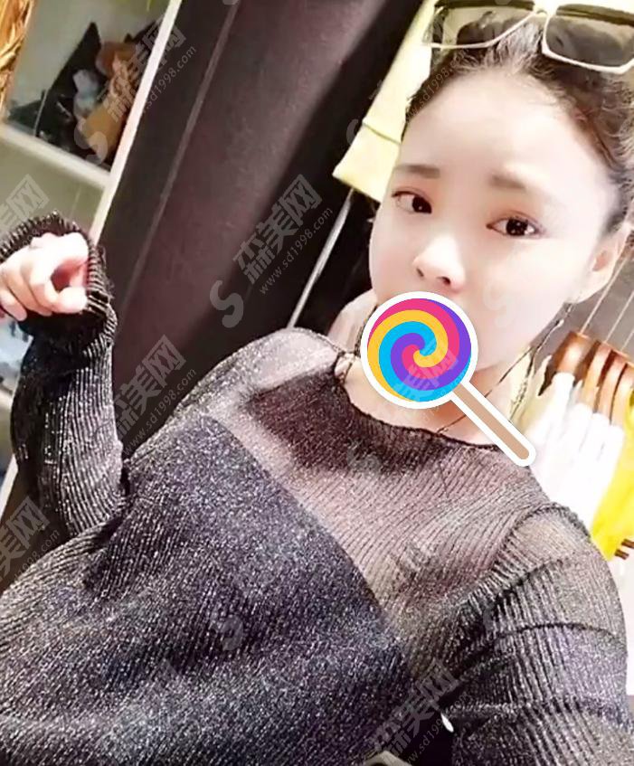 宁波113医院整形外科怎么样？附宁波113医院整形外科医院介绍及整形手术成功案例分享