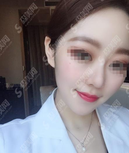 宁波二院美容科怎么样?宁波二院做的整形果怎么样?附医院介绍及案例分享