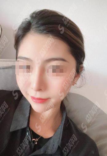 上海弟九人民医院美容科怎么样?上海九院的医师怎么样?上海九院整形案例