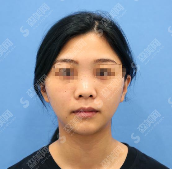 上海弟九人民医院美容科怎么样?上海九院的医师怎么样?上海九院整形案例