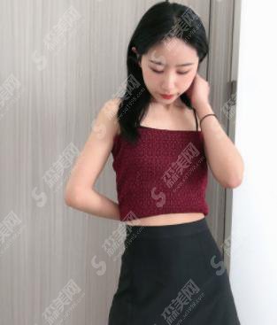 上海九院抽脂手术多少钱?附抽脂手术整形案例+术前术后果对比图