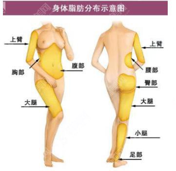 上海九院抽脂手术多少钱?附抽脂手术整形案例+术前术后果对比图