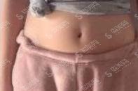 武汉三医院整形科怎么样？附武汉三医院整形科医院简介及整形手术成功案例分享