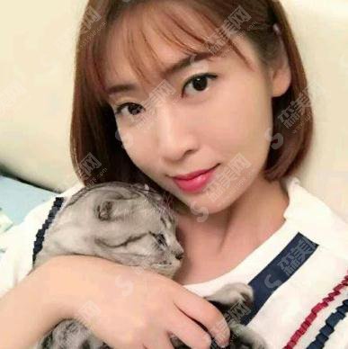 北医三院价目表2021，内含毕洪森医生面部除皱案例果图