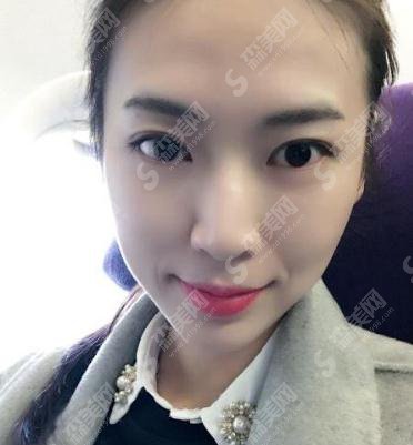 北医三院价目表2021，内含毕洪森医生面部除皱案例果图