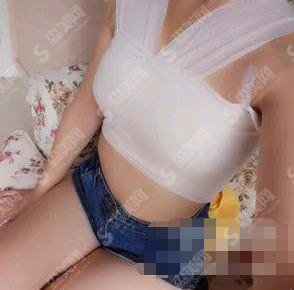 整形专家陈育哲隆胸技术好不好?深圳铭医医疗美容整形医院/口碑如何/隆胸案例