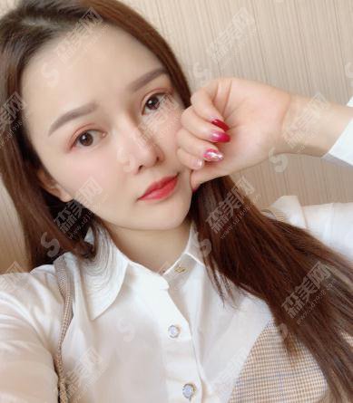 整形专家张海林自体脂肪全脸填充果好吗?内含填充案例果对比图