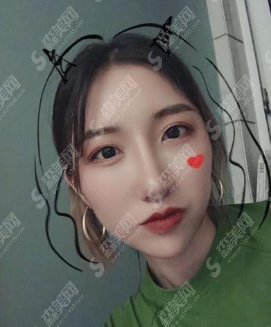 整形专家王友彬鼻部手术技术如何?北京协和医院整形美容外科/口碑好不好/鼻部手术案例