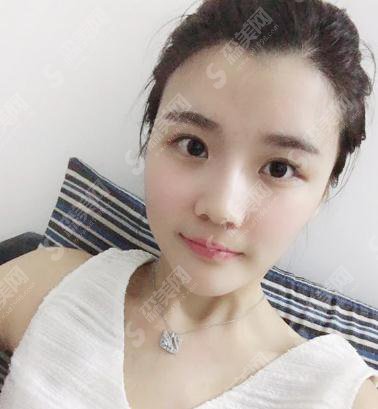 整形专家赵润蕾玻尿酸注射项目技术如何?北医三院整形科/个人简介/案例展示