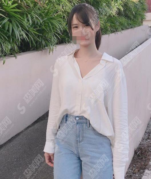 广州曙光整形医院靠谱吗？附广州曙光整形医院介绍及整形手术成功案例分享