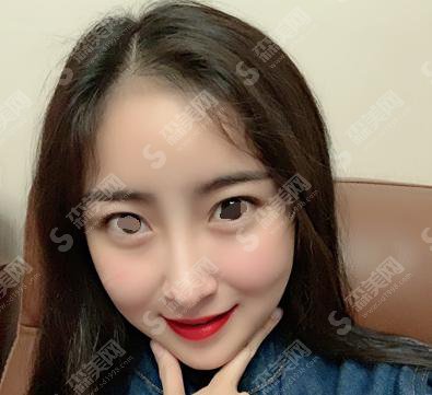 面部填充需要多少钱？附面部填充案例+前后果对比图