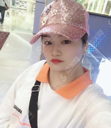 四川华美整形美容医院价目表2021，面部除皱费用？内含面部除皱案例果