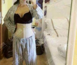 张晓威医生是怎样的?张晓威医生的技术实力盘点+腰腹吸脂的手术果案例图